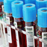 Blood Transfusion & Heamatology
