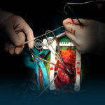 Cardiothoracic & Vascular Surgery (CTVS)