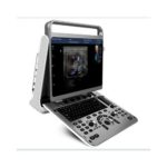 online medical product-chison-ebit-30-ultrasound-machine-
