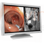 Online Medical Product - advin med grd monitor