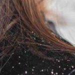 blog-dandruff