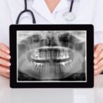 Dental Blog - digital-dental-xray