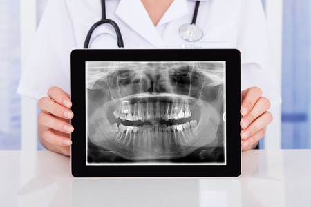 Dental Blog - digital-dental-xray